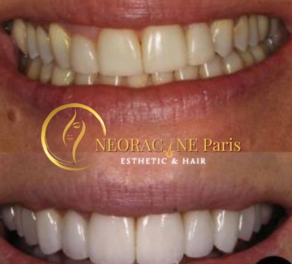 NEORACINE PARIS